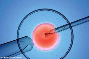 包生男孩试管机构生殖中心